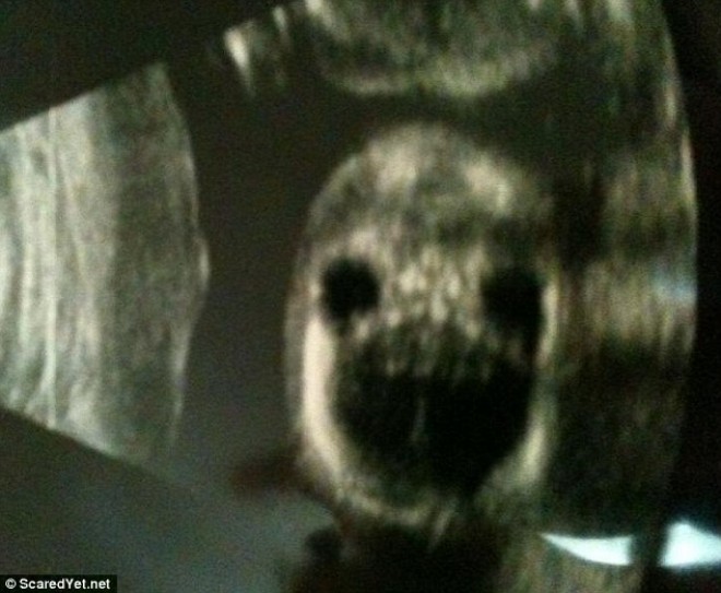 6 rémséges ultrahang fotó, amelyek láttán a szülők elborzadtak